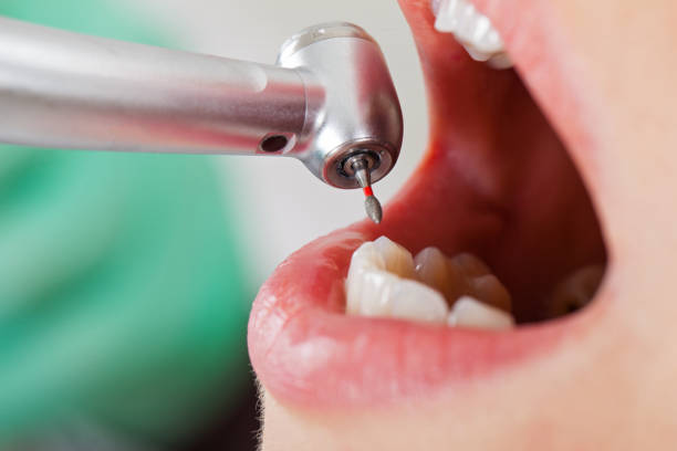 Best Pediatric Emergency Dentist in Orosi, CA